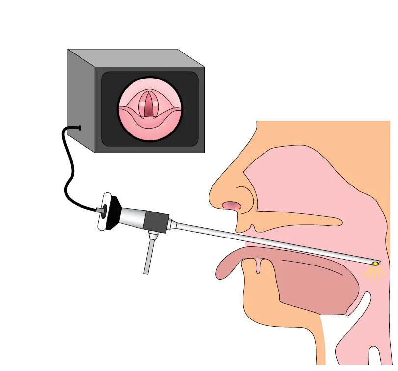 آندوسکوپی حنجره در کرمان