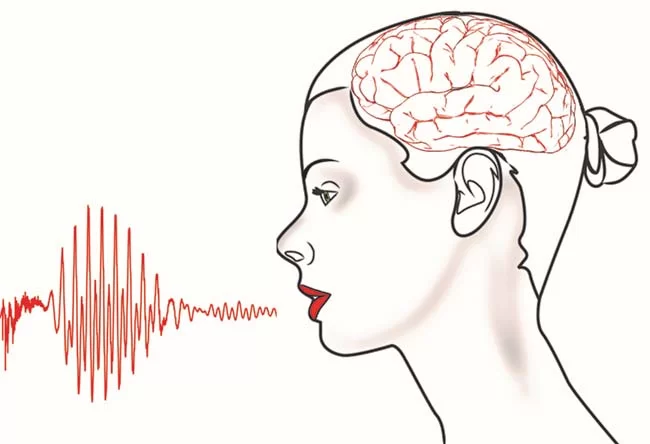 علت شل حرف زدن ناگهانی